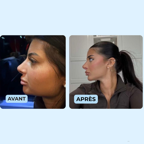 Yasmine M., 25 ans